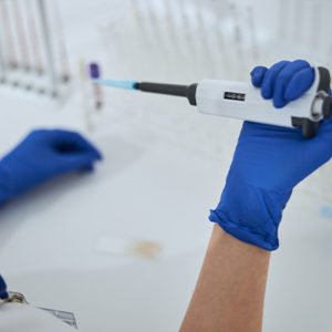 Urine Analyzers